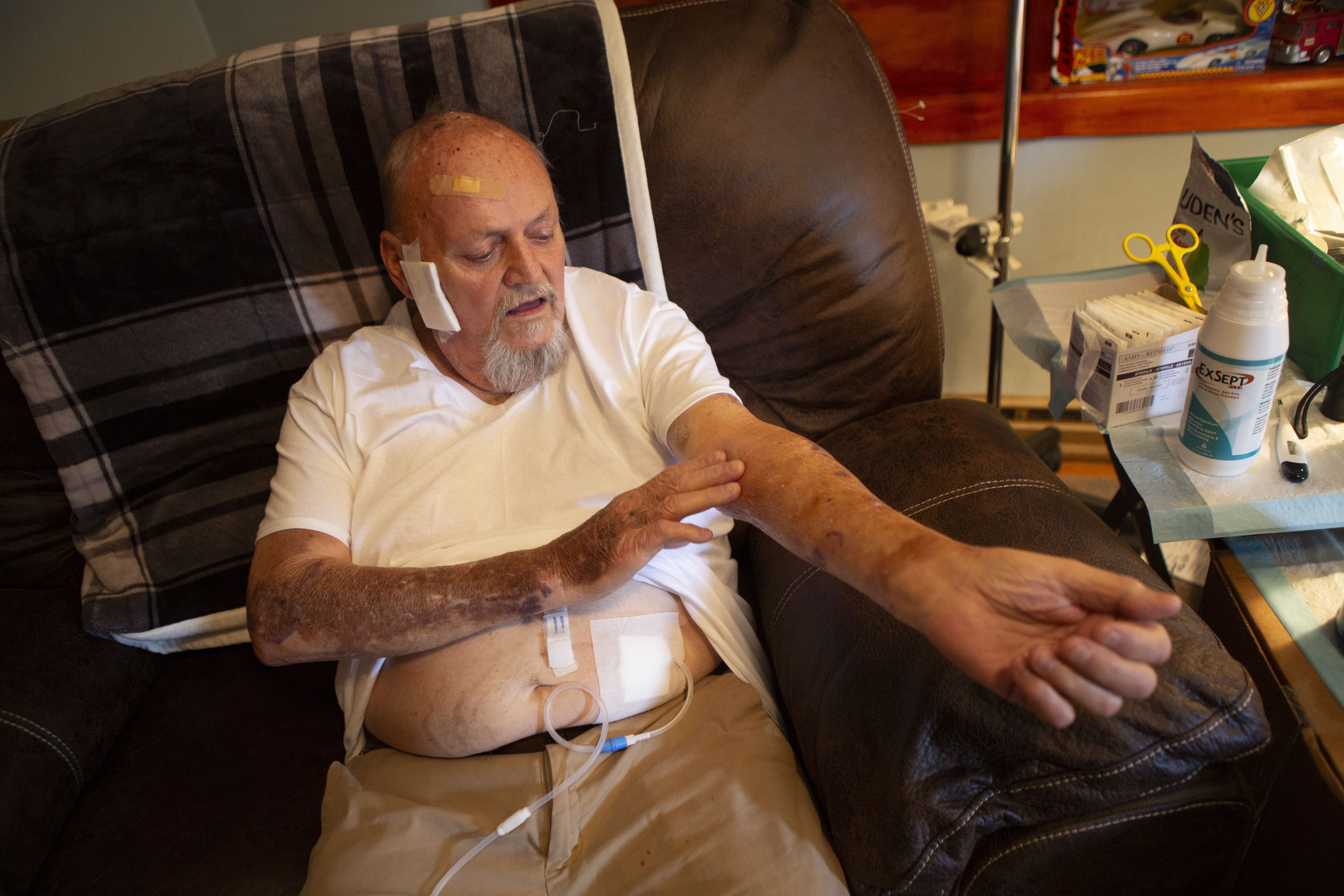 Man sitting in a chair, showing his arm.