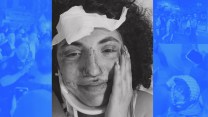 Photo collage featuring a young woman with a bloodied nose, bandages on her head, and a neck brace, overlaid on scenes of an attack by a group of Zionist men.