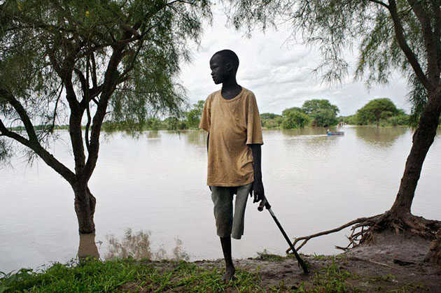 A young boy on the banks of the Gilo River, Jonglei State.  His leg was amputated due to lack of care after being bitten by a snake. Access to health care is a major challenge for South Sudan.