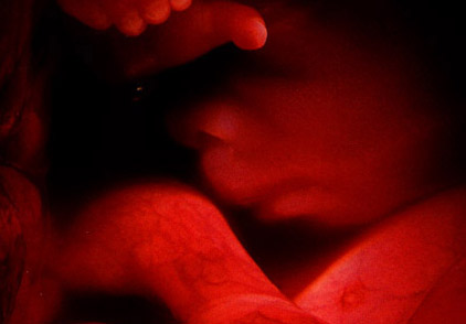 fetus2.jpg